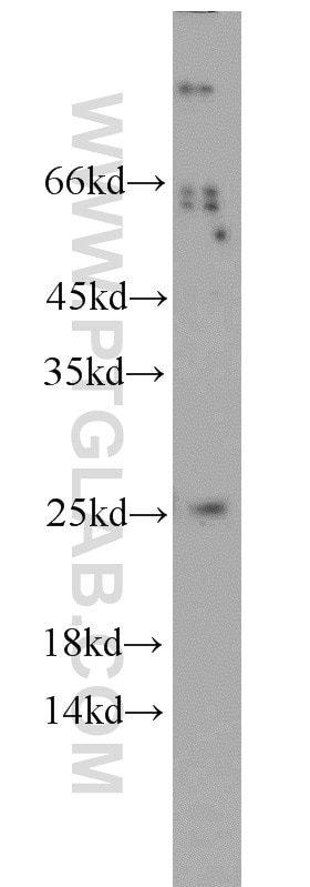 WB analysis of A431 using 14869-1-AP