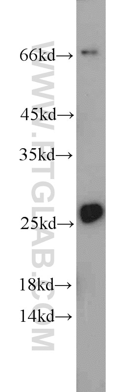 Western Blot (WB) analysis of mouse cerebellum tissue using Calcipressin 1 Polyclonal antibody (14869-1-AP)