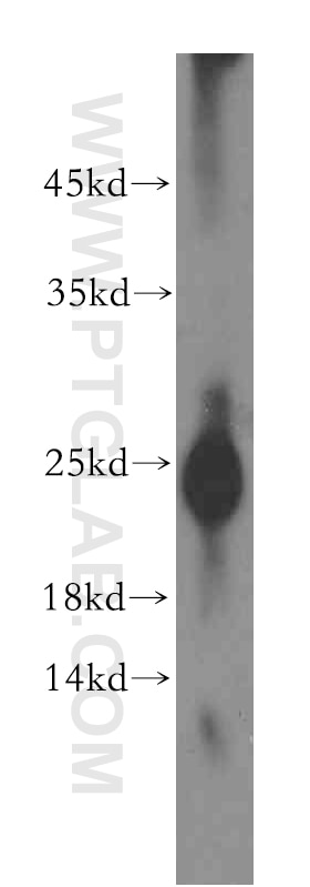 Western Blot (WB) analysis of human heart tissue using Calcipressin 1 Polyclonal antibody (14869-1-AP)