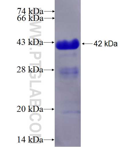 RCAN1 fusion protein Ag6457 SDS-PAGE