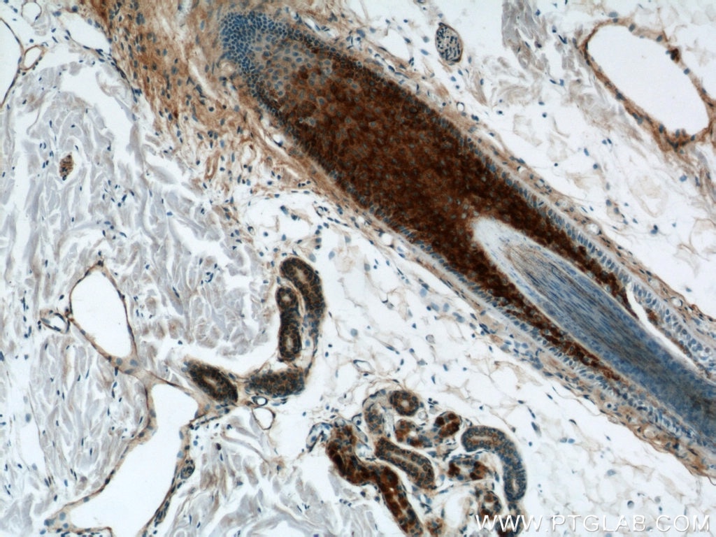 IHC staining of human skin using 12900-1-AP