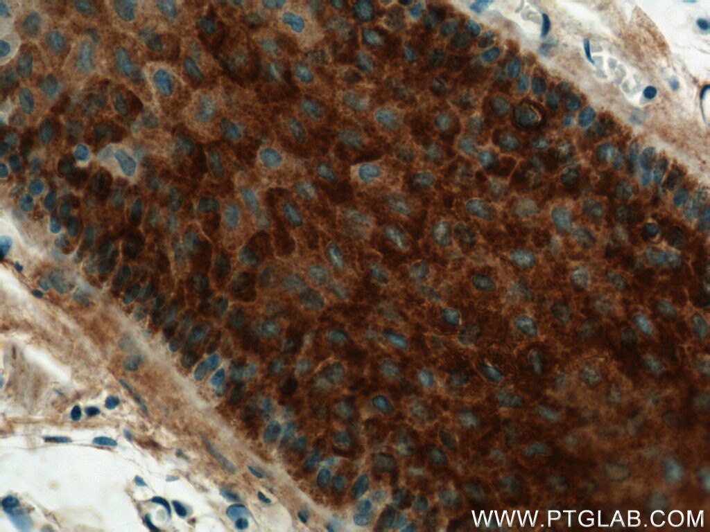 Immunohistochemistry (IHC) staining of human skin tissue using RCAN2 Polyclonal antibody (12900-1-AP)