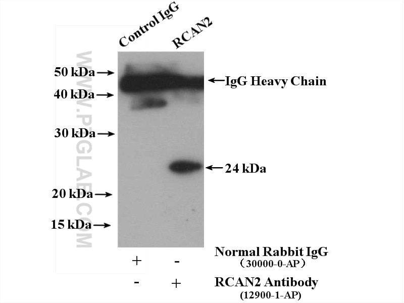 Immunoprecipitation (IP) experiment of mouse brain tissue using RCAN2 Polyclonal antibody (12900-1-AP)