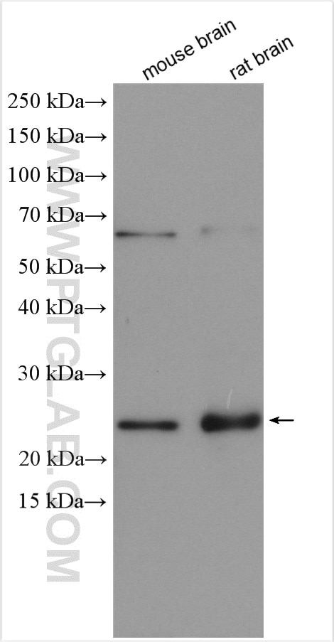 Western Blot (WB) analysis of various lysates using RCAN2 Polyclonal antibody (12900-1-AP)