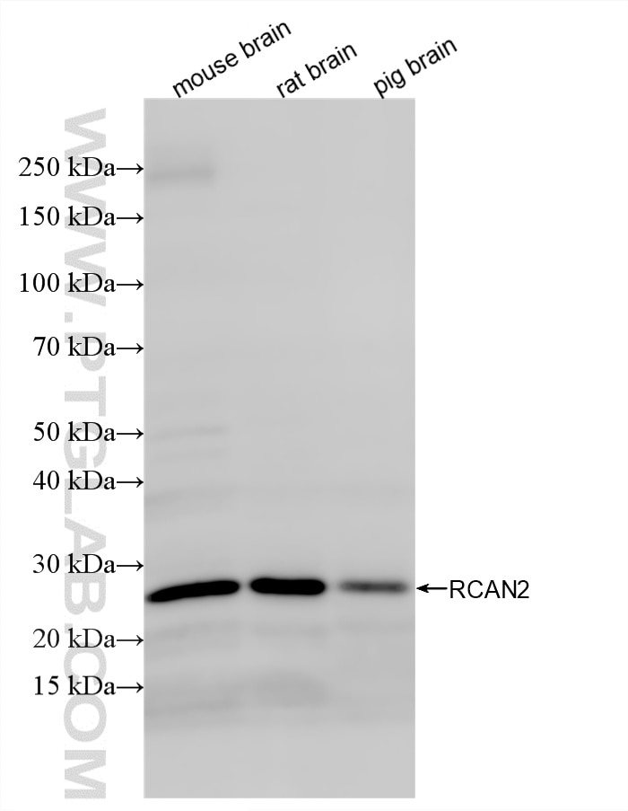 Western Blot (WB) analysis of various lysates using RCAN2 Recombinant antibody (86561-1-RR)