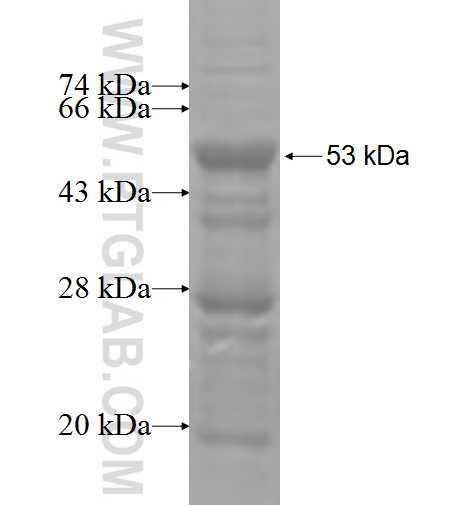 RCAN3 fusion protein Ag4587 SDS-PAGE