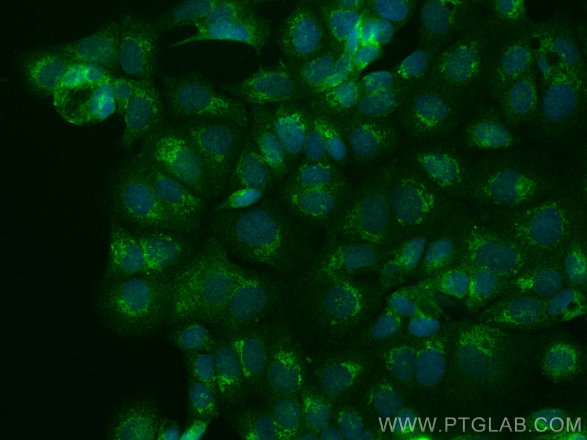 IF Staining of MCF-7 using CL488-66170