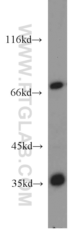 Western Blot (WB) analysis of mouse heart tissue using RCBTB1 Polyclonal antibody (55255-1-AP)