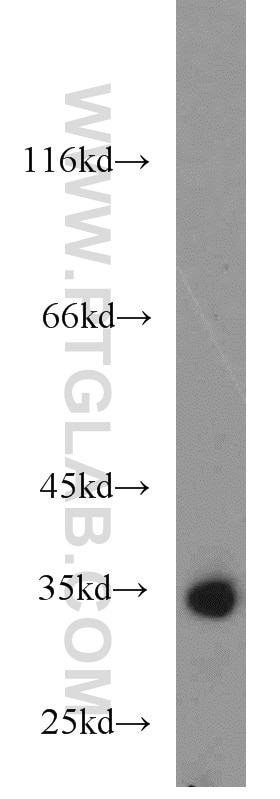 Western Blot (WB) analysis of K-562 cells using RCBTB1 Polyclonal antibody (55255-1-AP)