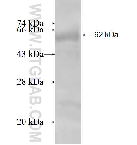 RCBTB1 fusion protein Ag3770 SDS-PAGE