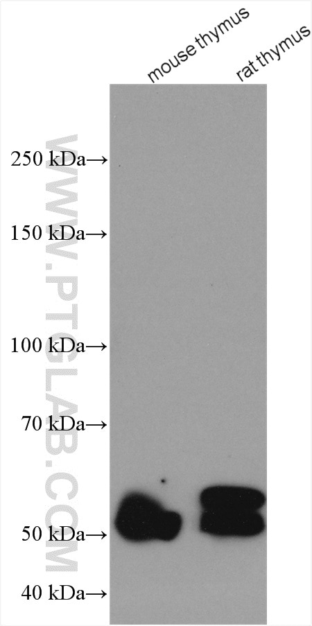 WB analysis using 13225-1-AP