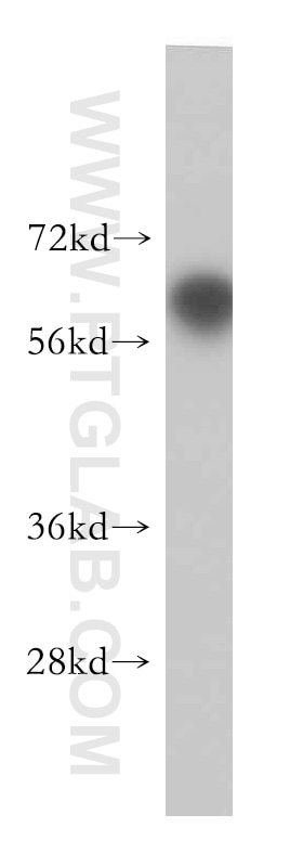 Western Blot (WB) analysis of mouse thymus tissue using RCBTB2 Polyclonal antibody (13225-1-AP)