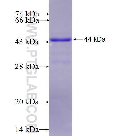 RCBTB2 fusion protein Ag6923 SDS-PAGE