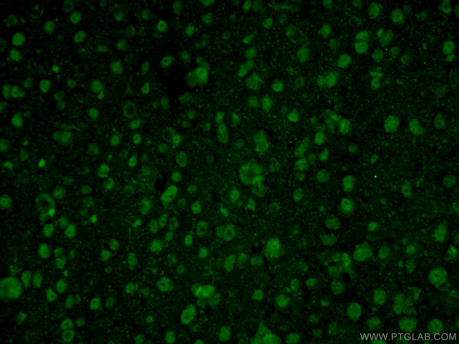 Immunofluorescence (IF) / fluorescent staining of mouse brain tissue using RCC1 Polyclonal antibody (22142-1-AP)