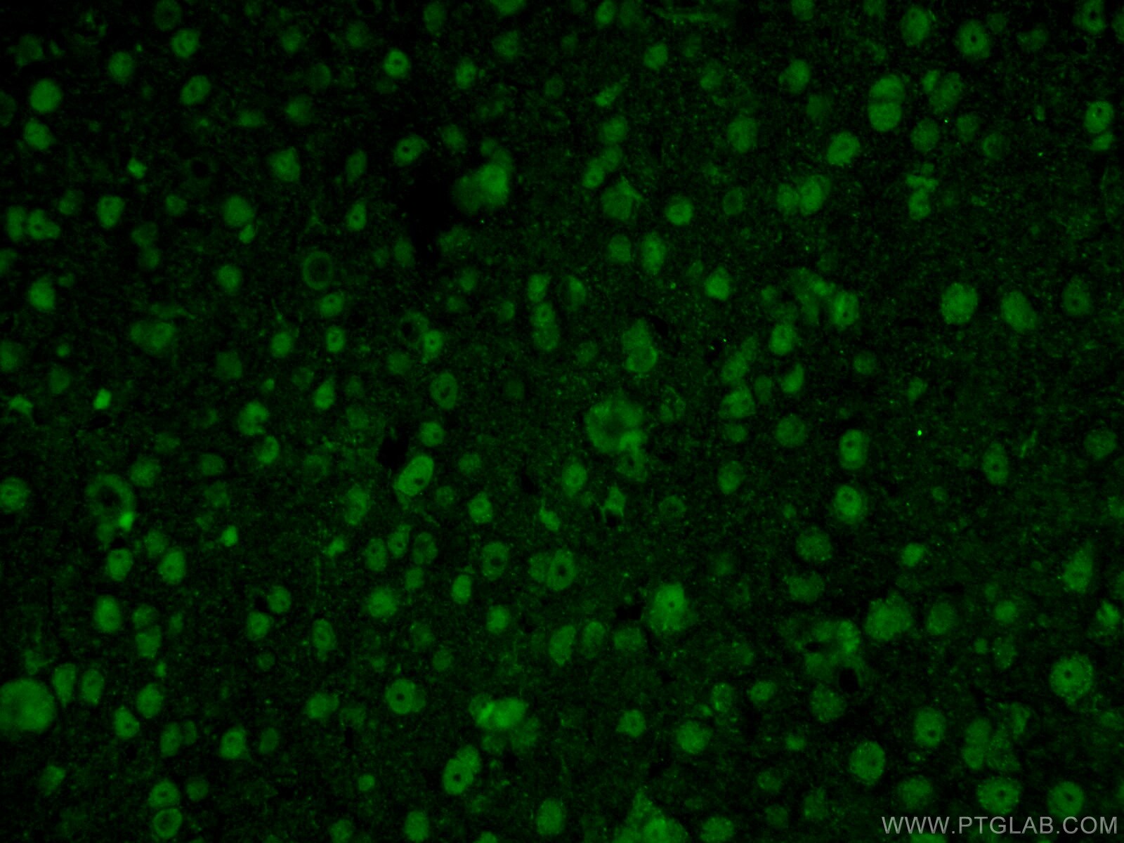 Immunofluorescence (IF) / fluorescent staining of mouse brain tissue using RCC1 Polyclonal antibody (22142-1-AP)