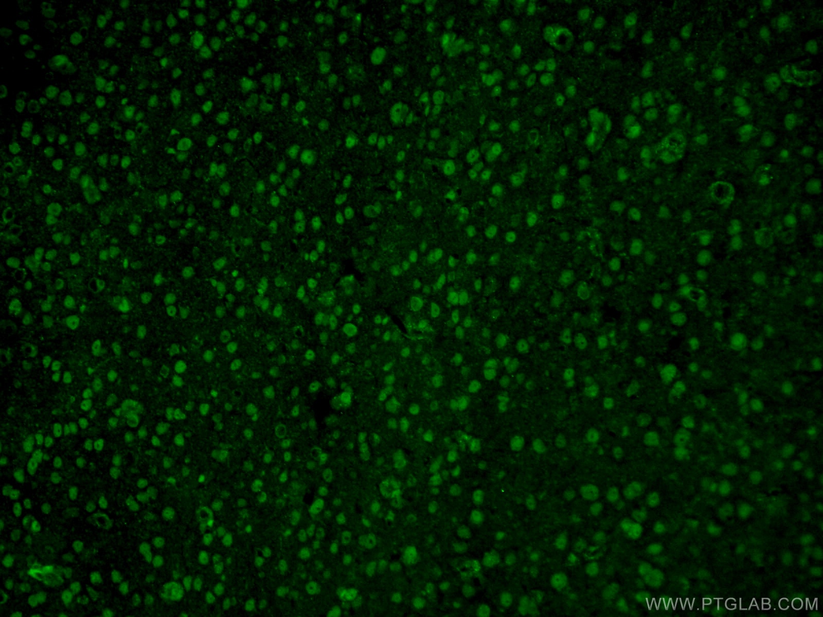 Immunofluorescence (IF) / fluorescent staining of mouse brain tissue using RCC1 Polyclonal antibody (22142-1-AP)
