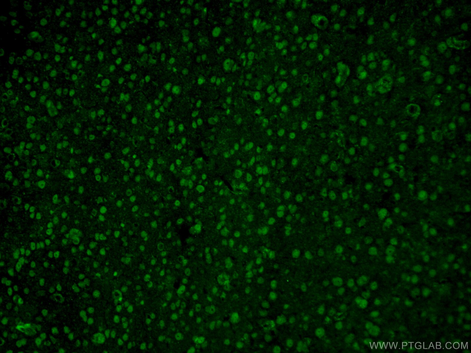 Immunofluorescence (IF) / fluorescent staining of mouse brain tissue using RCC1 Polyclonal antibody (22142-1-AP)