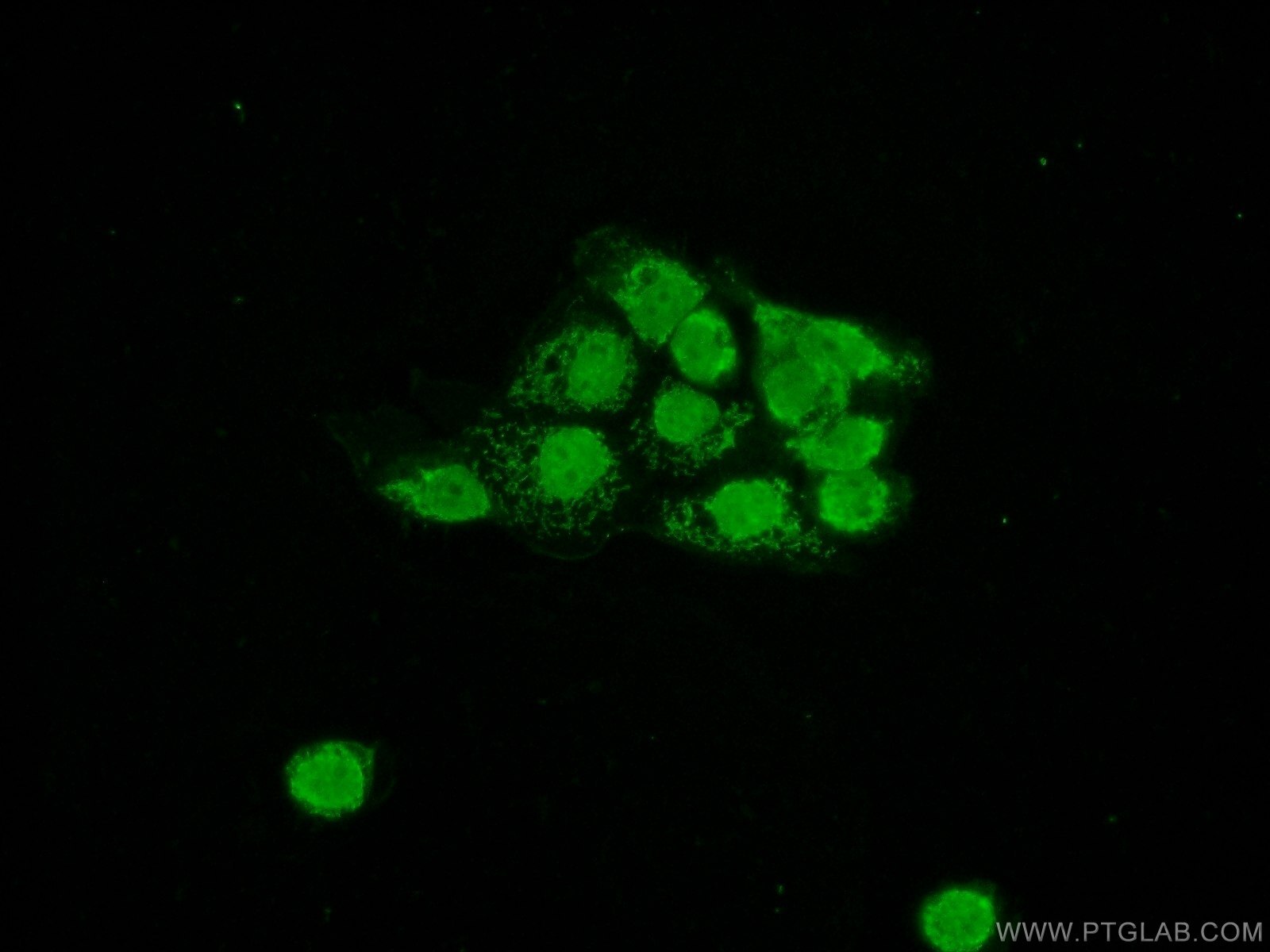 Immunofluorescence (IF) / fluorescent staining of A431 cells using RCC1 Polyclonal antibody (22142-1-AP)