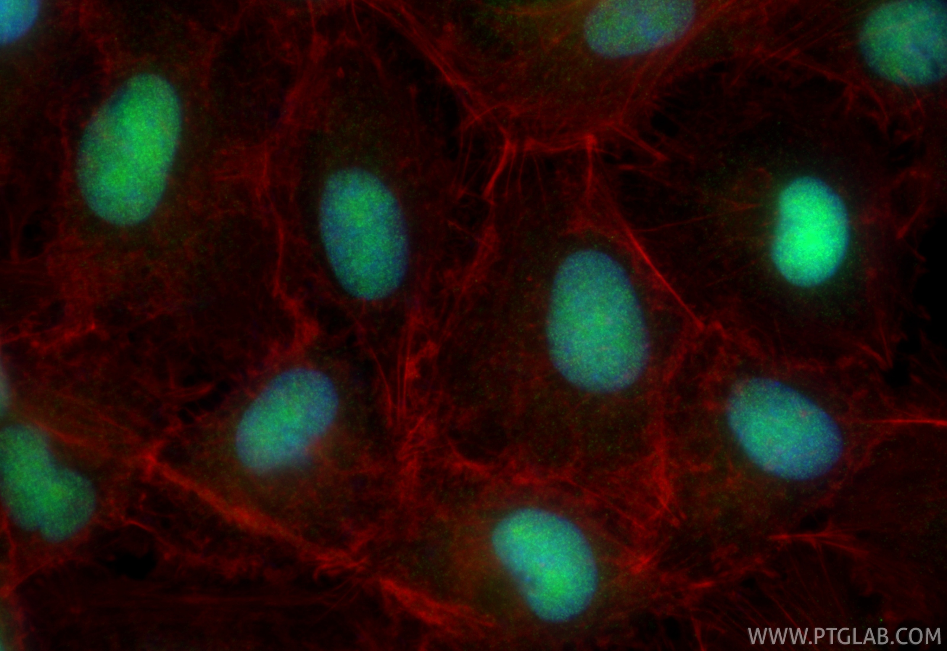 Immunofluorescence (IF) / fluorescent staining of A549 cells using RCC1 Polyclonal antibody (22142-1-AP)