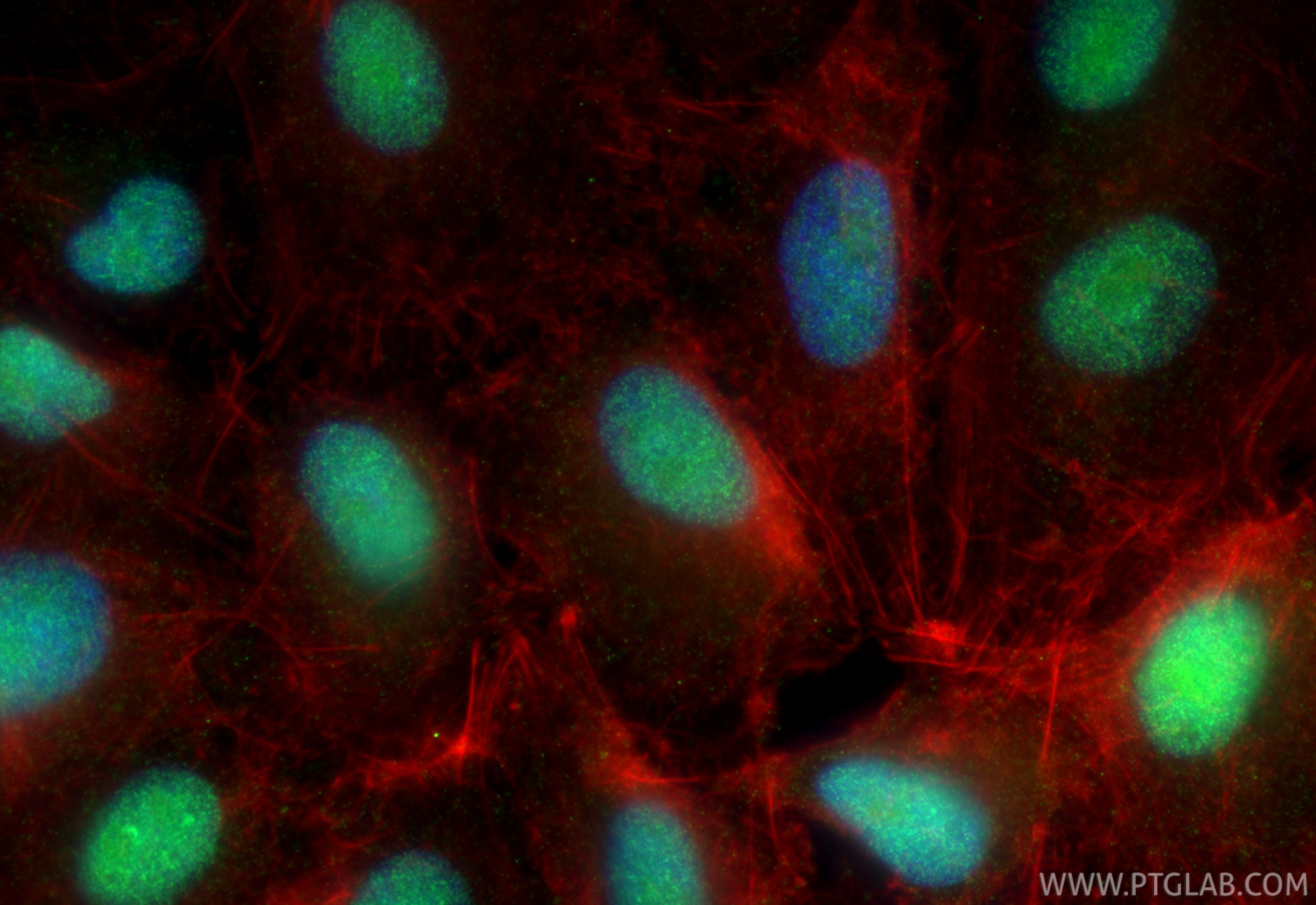 Immunofluorescence (IF) / fluorescent staining of A549 cells using RCC1 Polyclonal antibody (22142-1-AP)