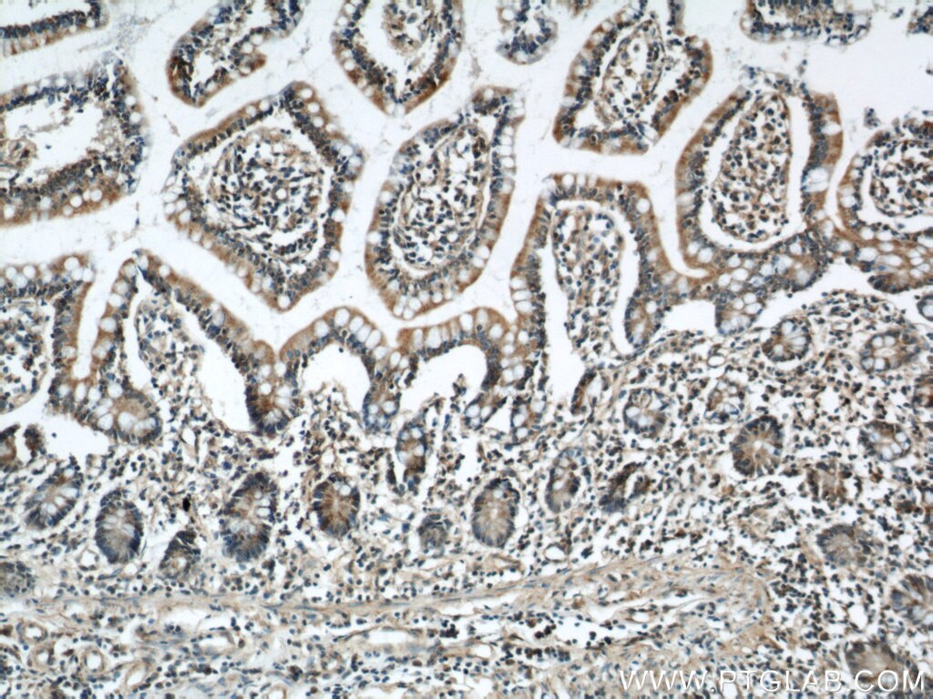 Immunohistochemistry (IHC) staining of human small intestine tissue using RCC1 Polyclonal antibody (22142-1-AP)