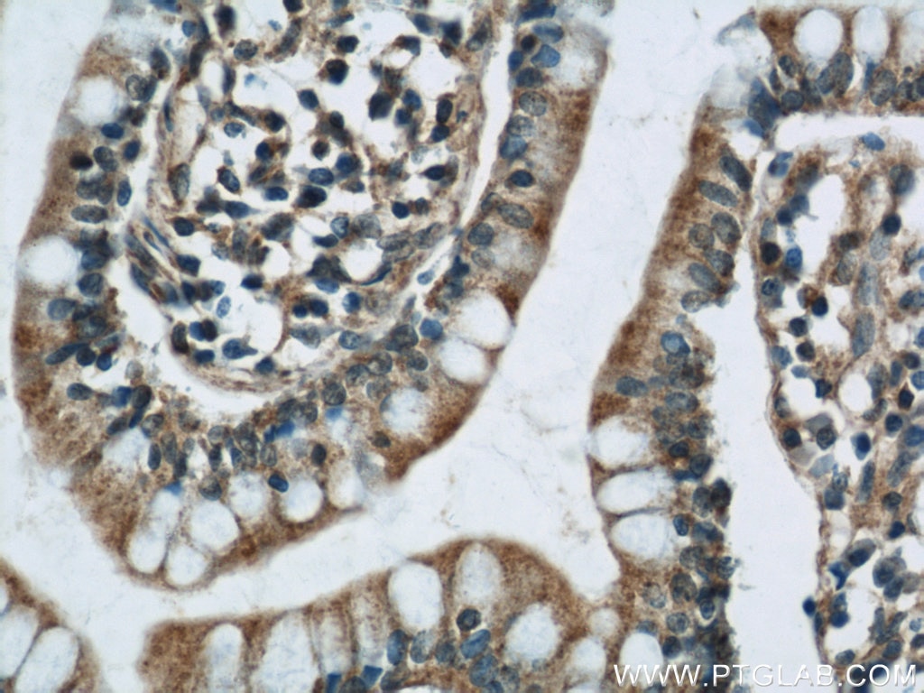 Immunohistochemistry (IHC) staining of human small intestine tissue using RCC1 Polyclonal antibody (22142-1-AP)