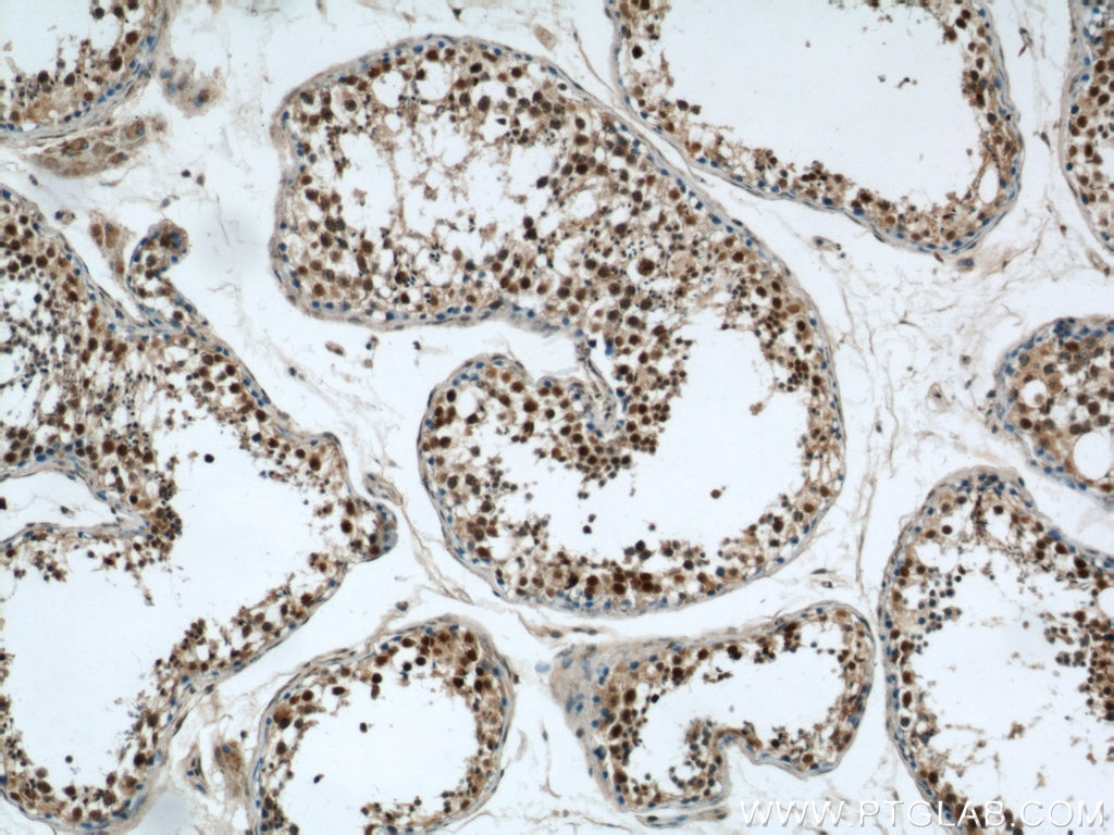 Immunohistochemistry (IHC) staining of human testis tissue using RCC1 Polyclonal antibody (22142-1-AP)