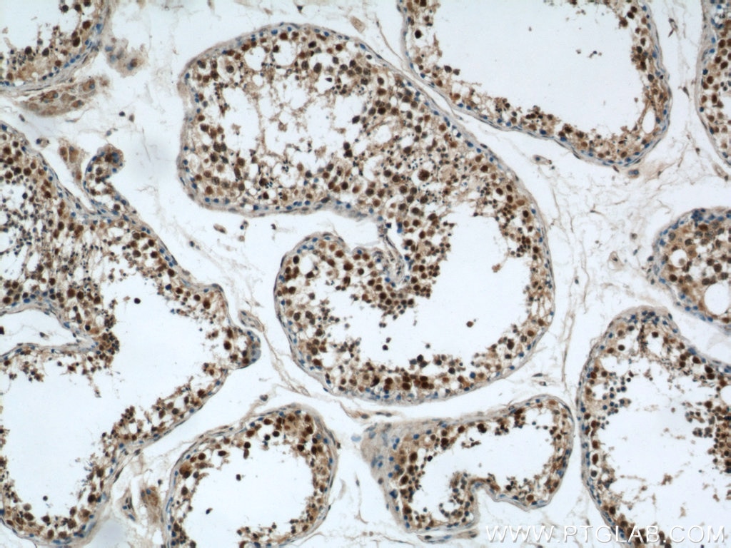 IHC staining of human testis using 22142-1-AP