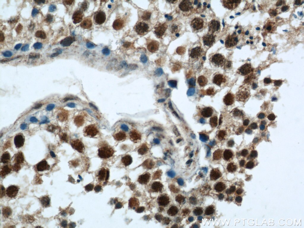 Immunohistochemistry (IHC) staining of human testis tissue using RCC1 Polyclonal antibody (22142-1-AP)