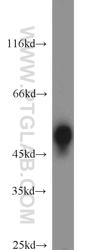 Western Blot (WB) analysis of HEK-293 cells using RCC1 Polyclonal antibody (22142-1-AP)