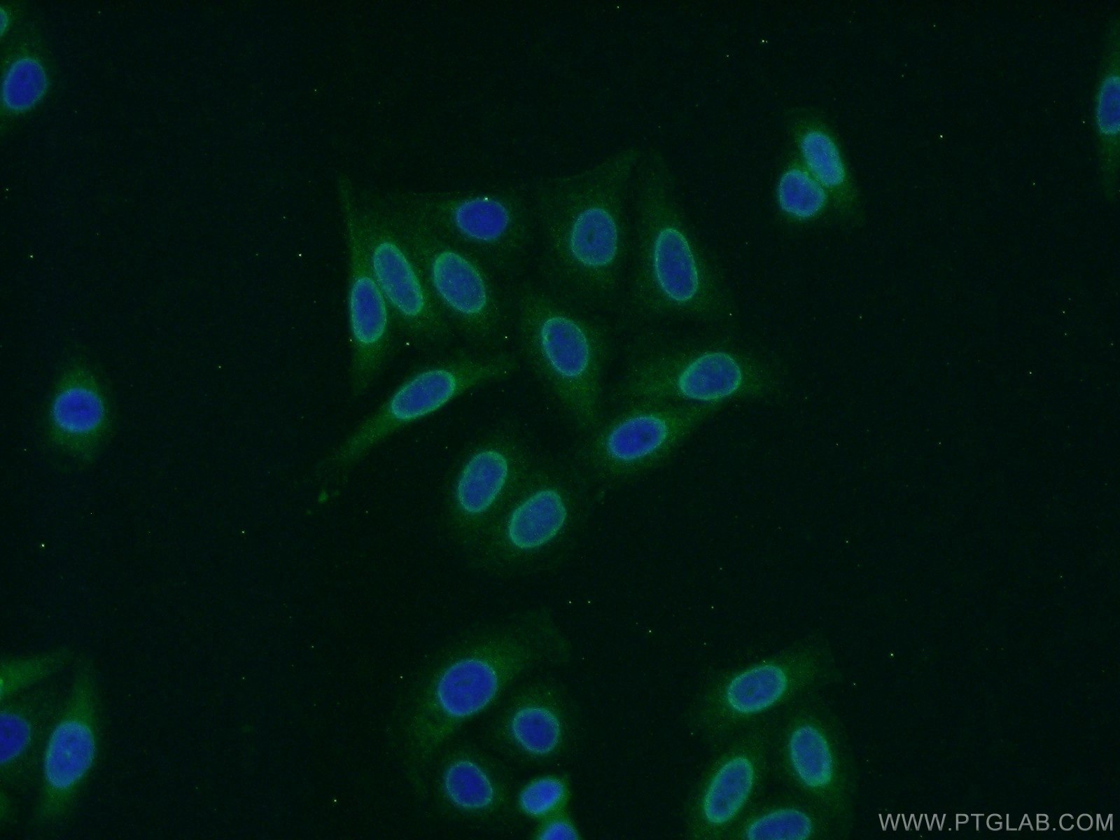 Immunofluorescence (IF) / fluorescent staining of HepG2 cells using RCC1 Polyclonal antibody (22335-1-AP)