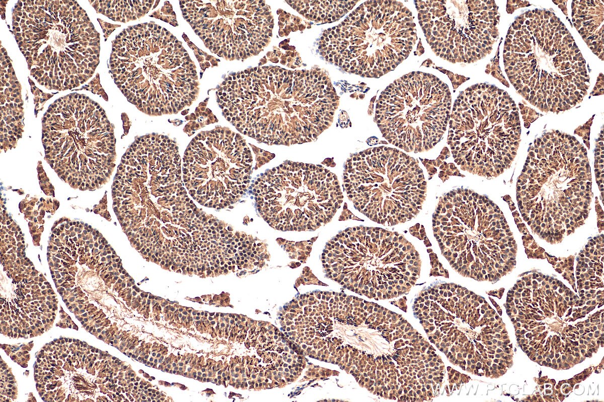 Immunohistochemistry (IHC) staining of mouse testis tissue using RCC1 Polyclonal antibody (22335-1-AP)