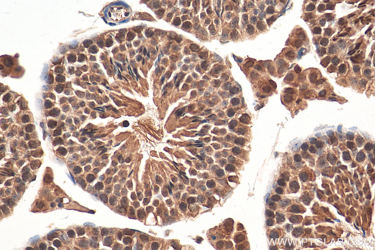 Immunohistochemistry (IHC) staining of mouse testis tissue using RCC1 Polyclonal antibody (22335-1-AP)