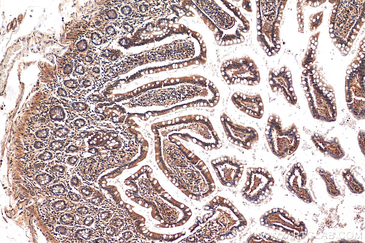 Immunohistochemistry (IHC) staining of human small intestine tissue using RCC1 Polyclonal antibody (22335-1-AP)