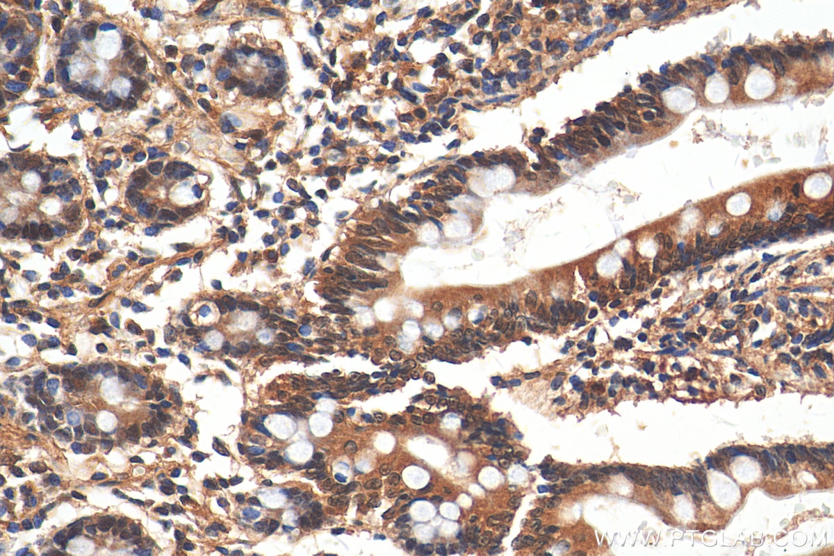 Immunohistochemistry (IHC) staining of human small intestine tissue using RCC1 Polyclonal antibody (22335-1-AP)