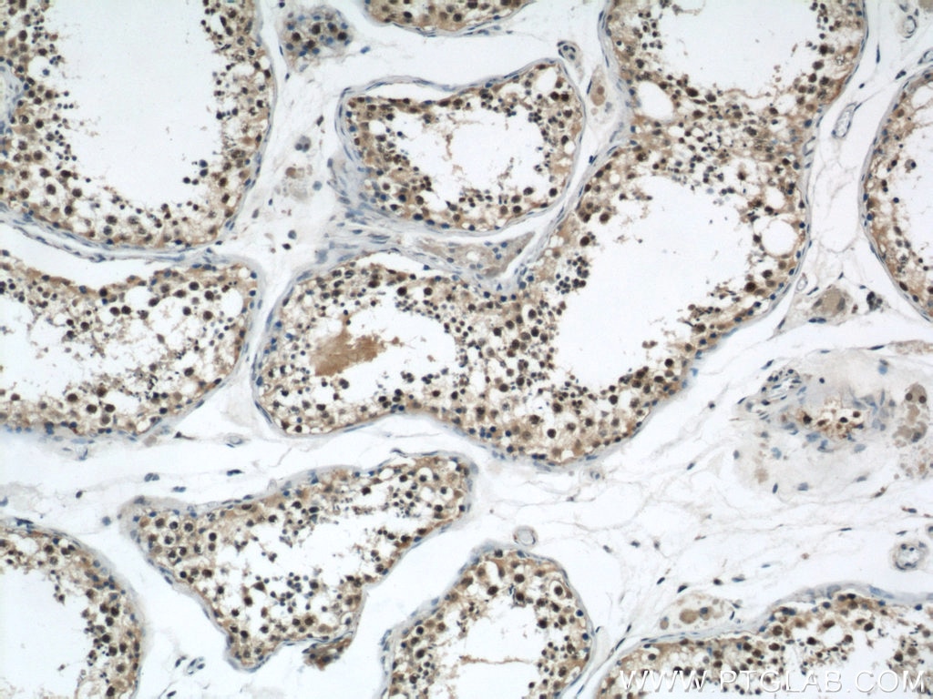 Immunohistochemistry (IHC) staining of human testis tissue using RCC1 Polyclonal antibody (22335-1-AP)
