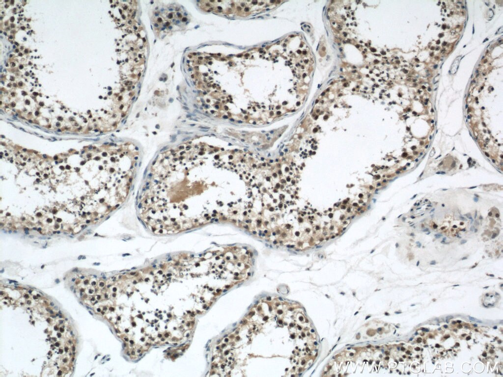 IHC staining of human testis using 22335-1-AP