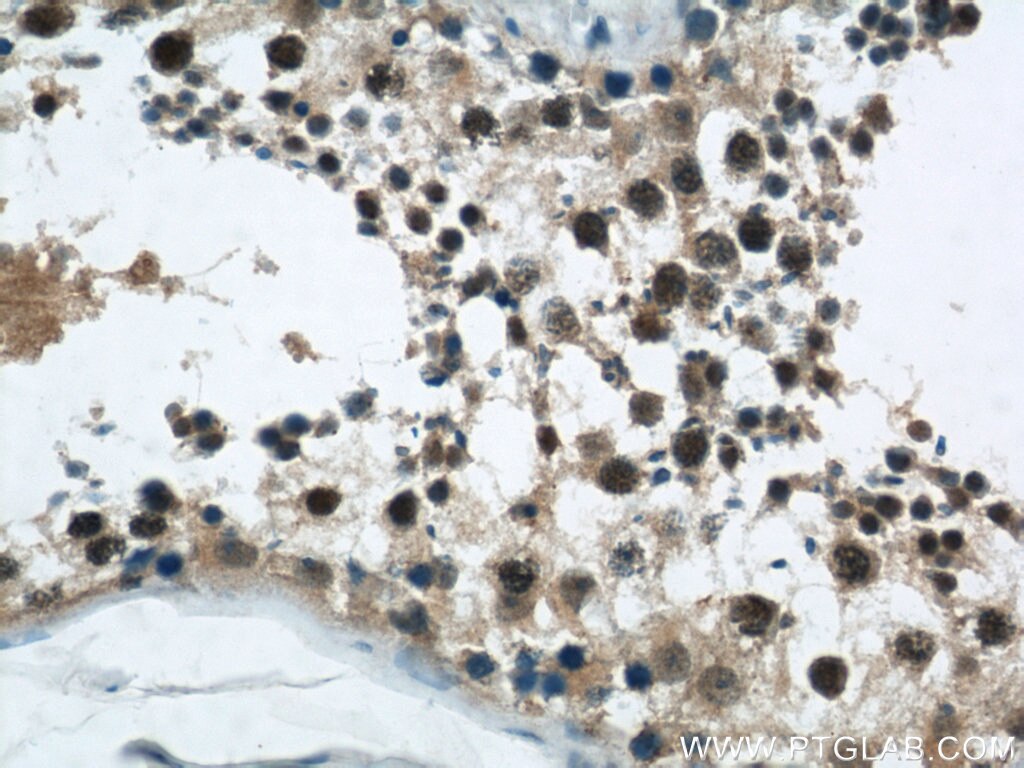Immunohistochemistry (IHC) staining of human testis tissue using RCC1 Polyclonal antibody (22335-1-AP)