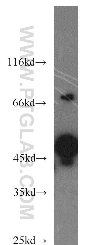 Western Blot (WB) analysis of HepG2 cells using RCC1 Polyclonal antibody (22335-1-AP)