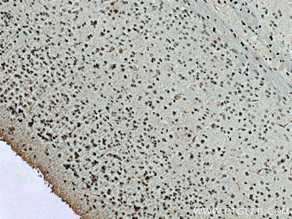 IHC staining of mouse brain using 67335-1-Ig