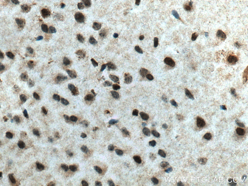Immunohistochemistry (IHC) staining of mouse brain tissue using RCC1 Monoclonal antibody (67335-1-Ig)