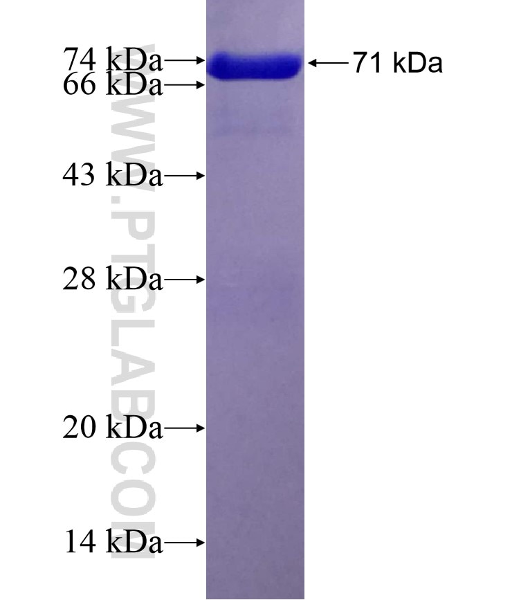 RCC1 fusion protein Ag17809 SDS-PAGE