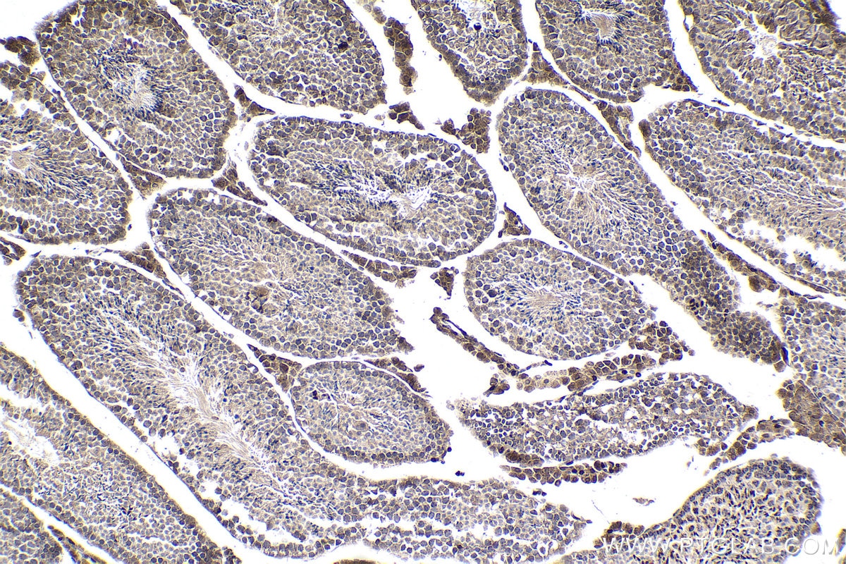 Immunohistochemistry (IHC) staining of mouse testis tissue using RCC2 Polyclonal antibody (16755-1-AP)
