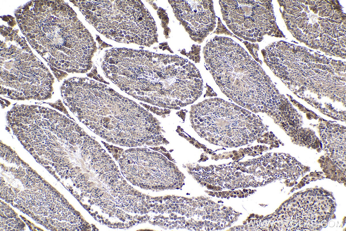 IHC staining of mouse testis using 16755-1-AP