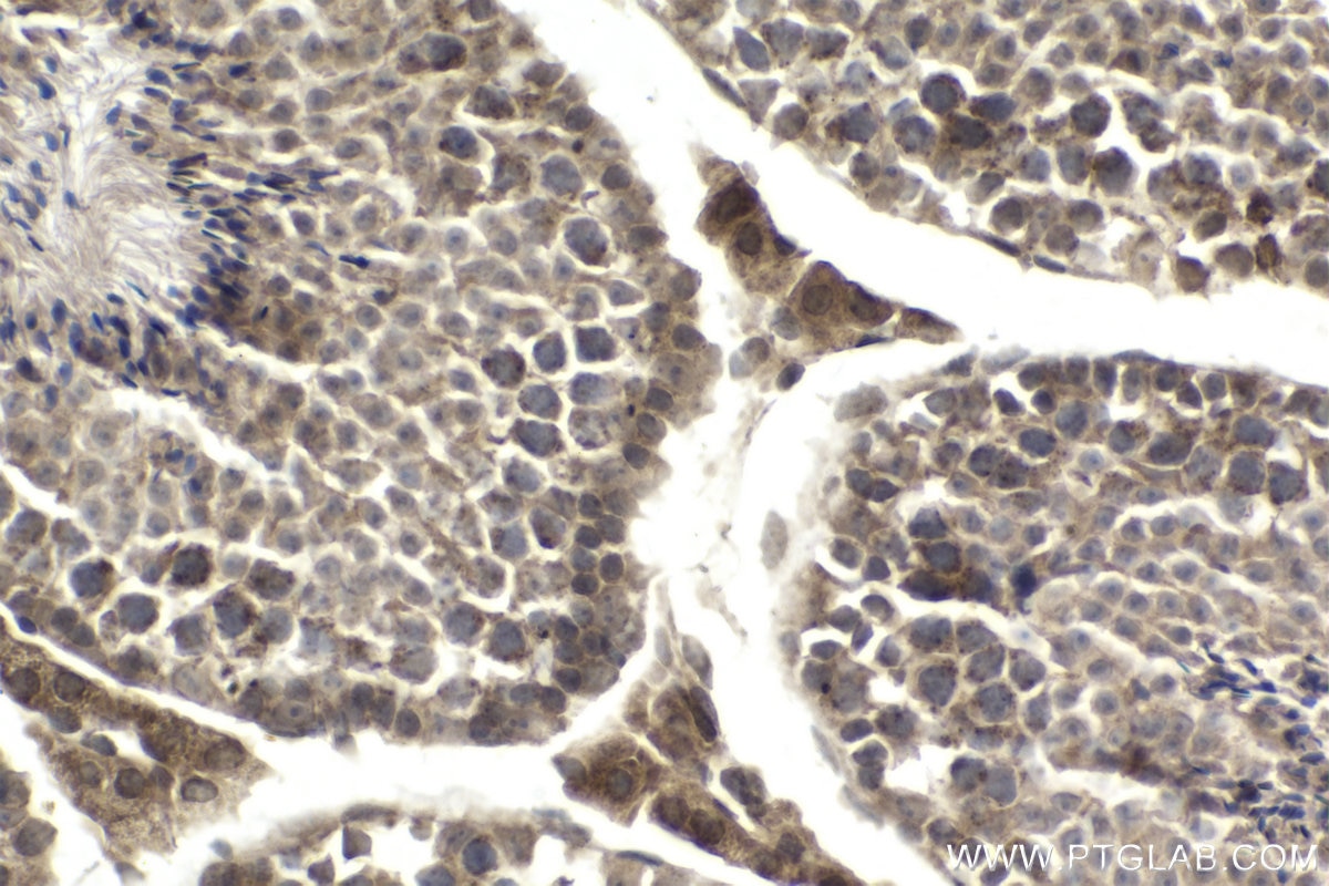 IHC staining of mouse testis using 16755-1-AP