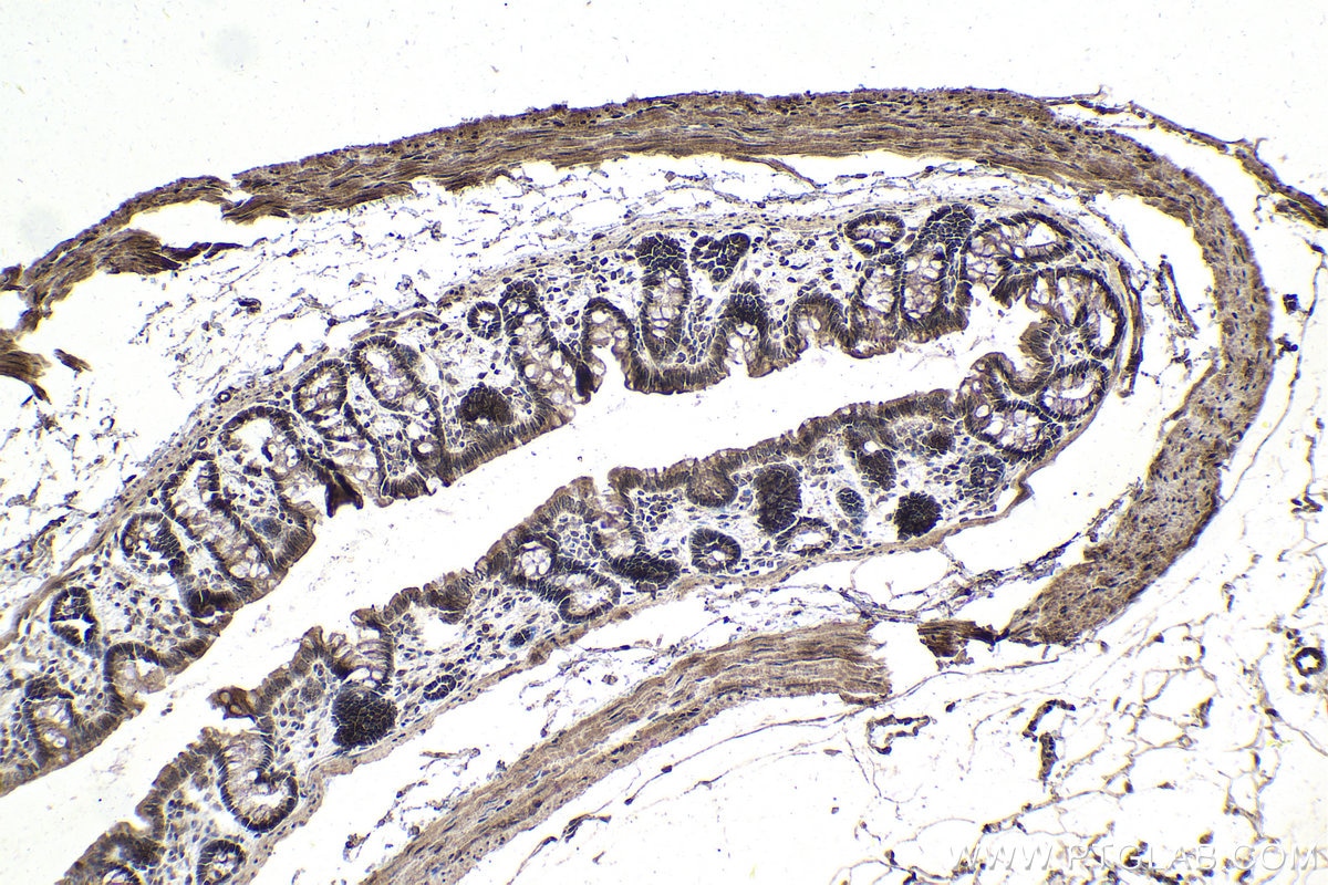 IHC staining of rat colon using 16755-1-AP