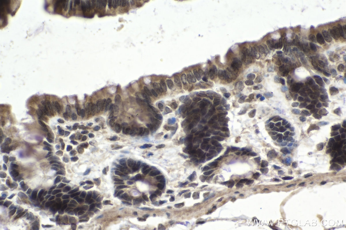 Immunohistochemistry (IHC) staining of rat colon tissue using RCC2 Polyclonal antibody (16755-1-AP)