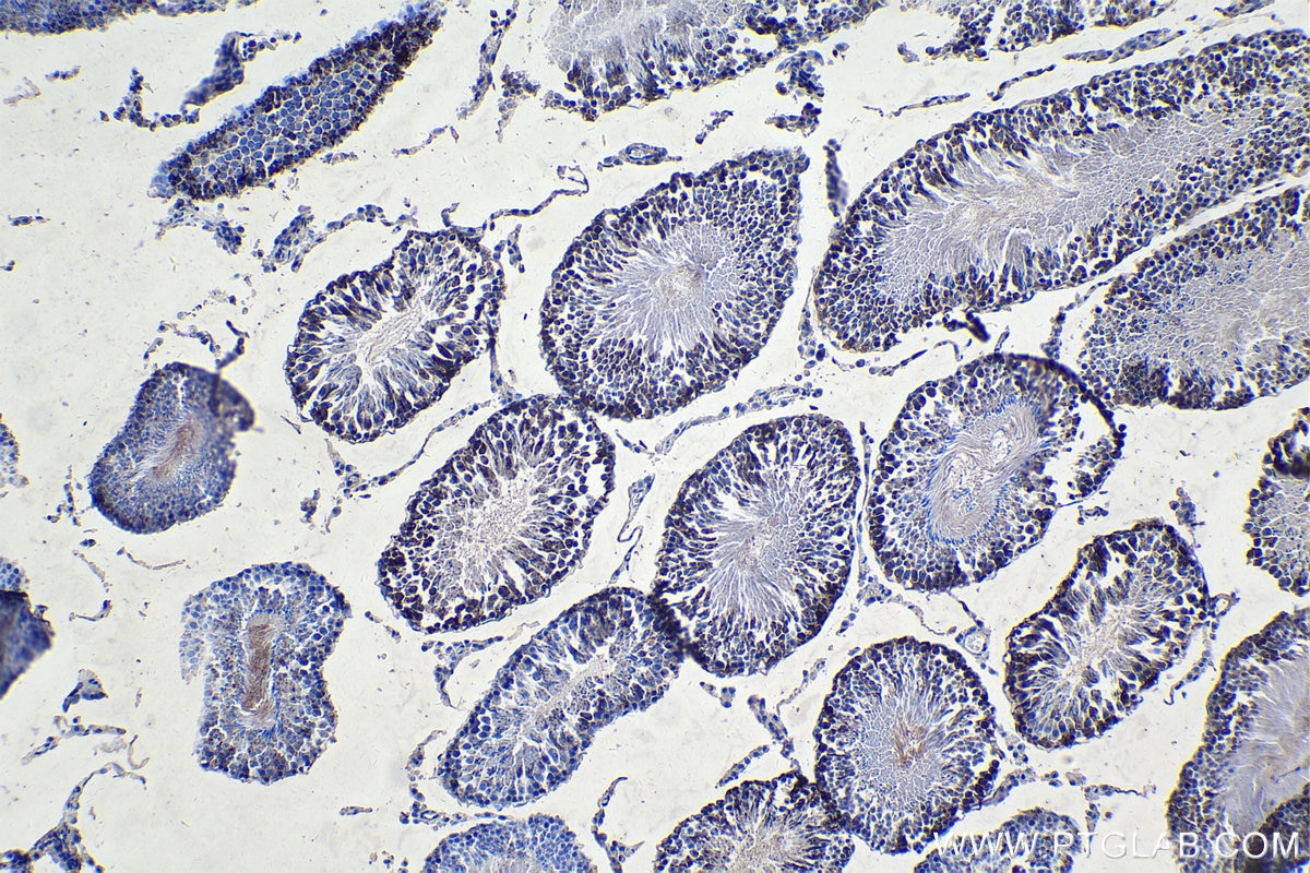 IHC staining of rat testis using 16755-1-AP