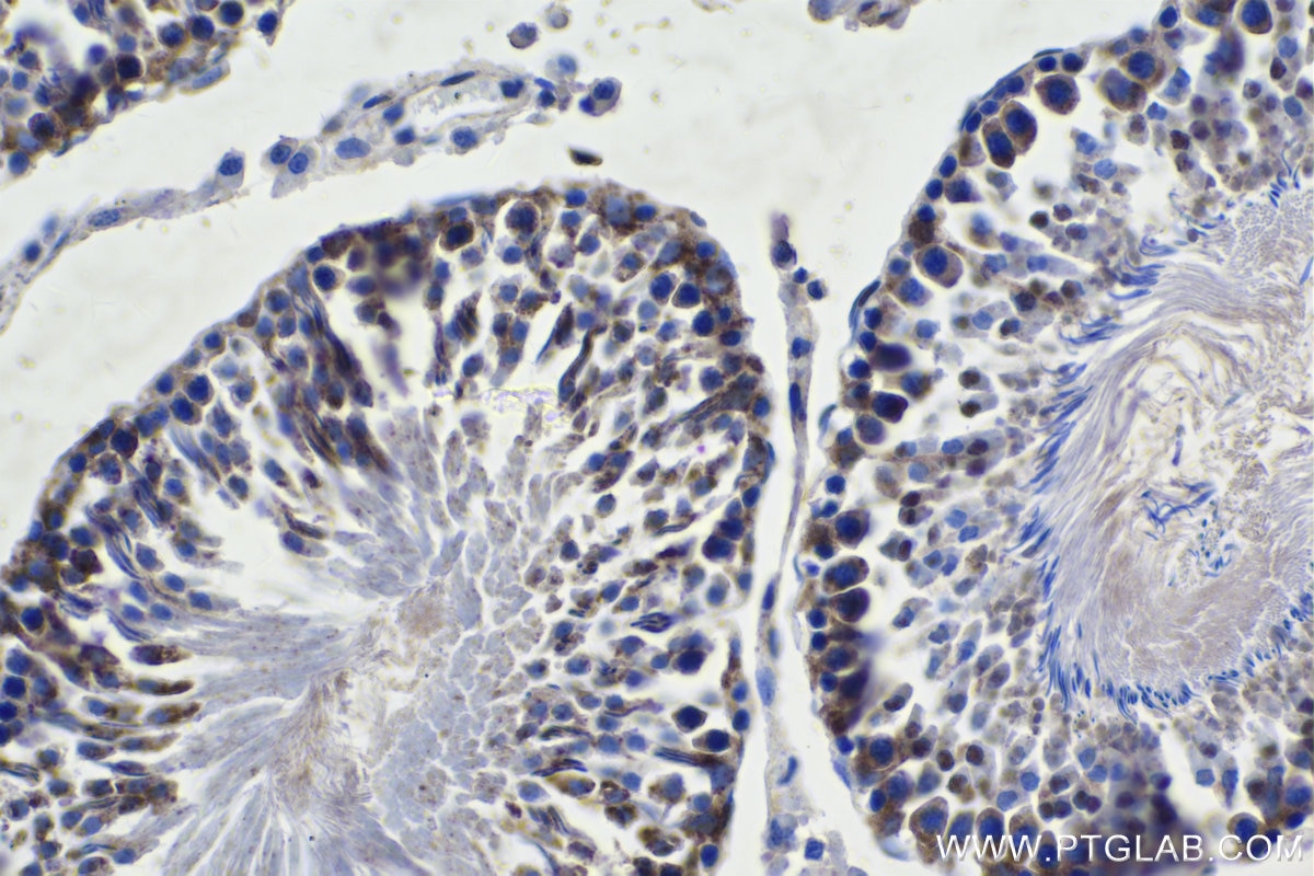 Immunohistochemistry (IHC) staining of rat testis tissue using RCC2 Polyclonal antibody (16755-1-AP)