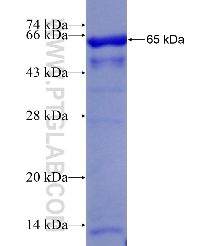 RCC2 fusion protein Ag10271 SDS-PAGE